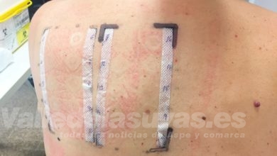 Estudio pruebas parche