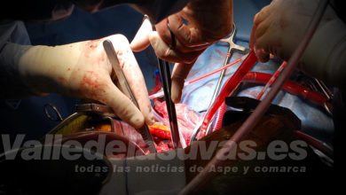 cirugía cardiovascular