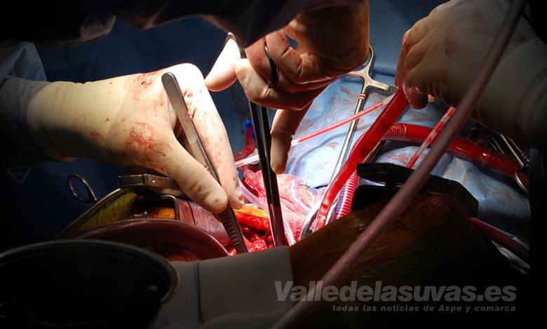 cirugía cardiovascular