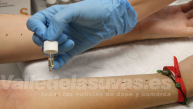 Prueba alergia
